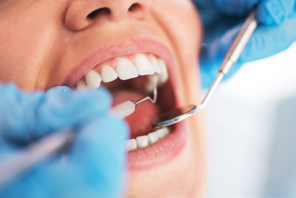 Oral health examination